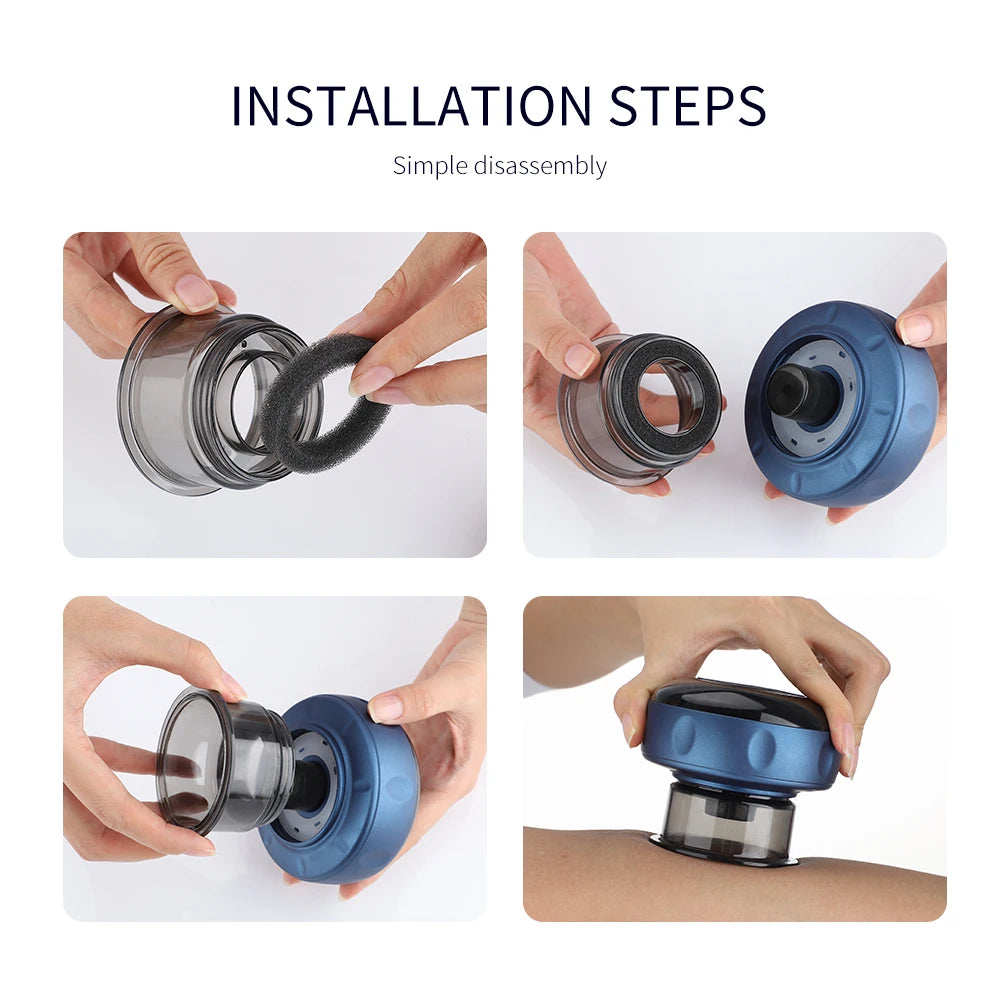 Electric Vacuum Cupping Massager – Anti-Cellulite Body Therapy, Gua Sha Scraping & Slimming Device