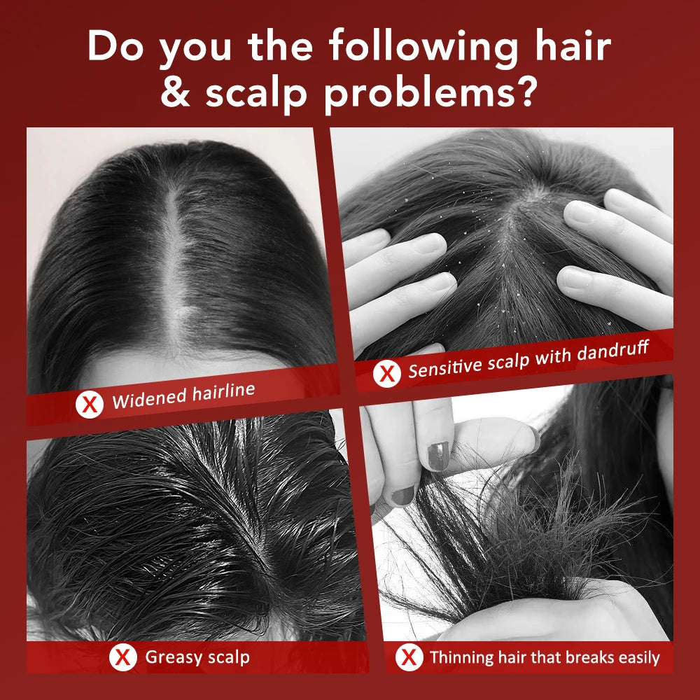 Hair and scalp problems including widened hairline sensitive scalp with dandruff greasy scalp and thinning hair for electric scalp massager for hair growth
