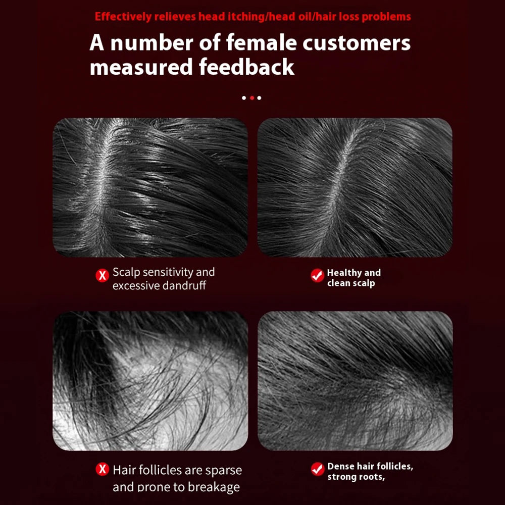 Before and after images showing scalp improvement and denser hair after using electric scalp massager for hair growth