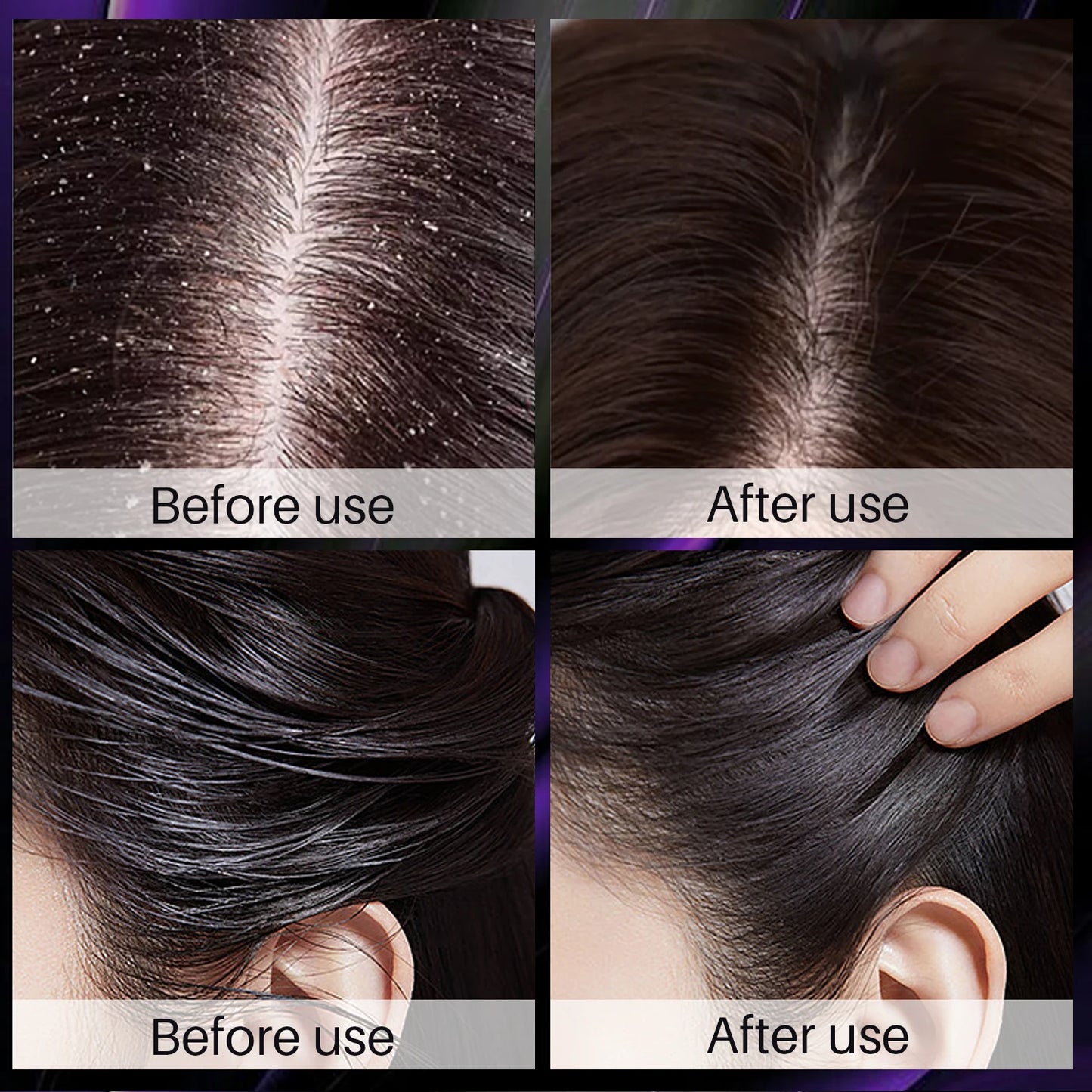 Before and after results showing scalp and hair improvement using rosemary onion hair growth shampoo by Sacred Self Wellness