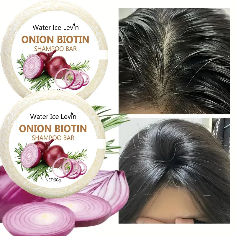 Sacred Self Wellness onion biotin shampoo bar with before and after hair scalp showing improved hair thickness