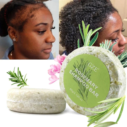 Rosemary shampoo bar for hair growth by SACRED SELF WELLNESS with before and after hair improvement results