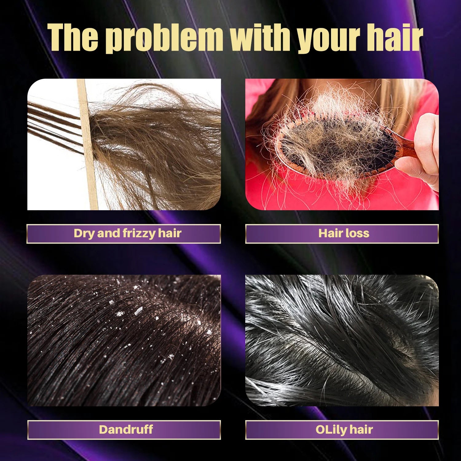 Collage showing hair problems including dry frizzy hair, hair loss, dandruff, and oily hair for rosemary onion hair growth shampoo